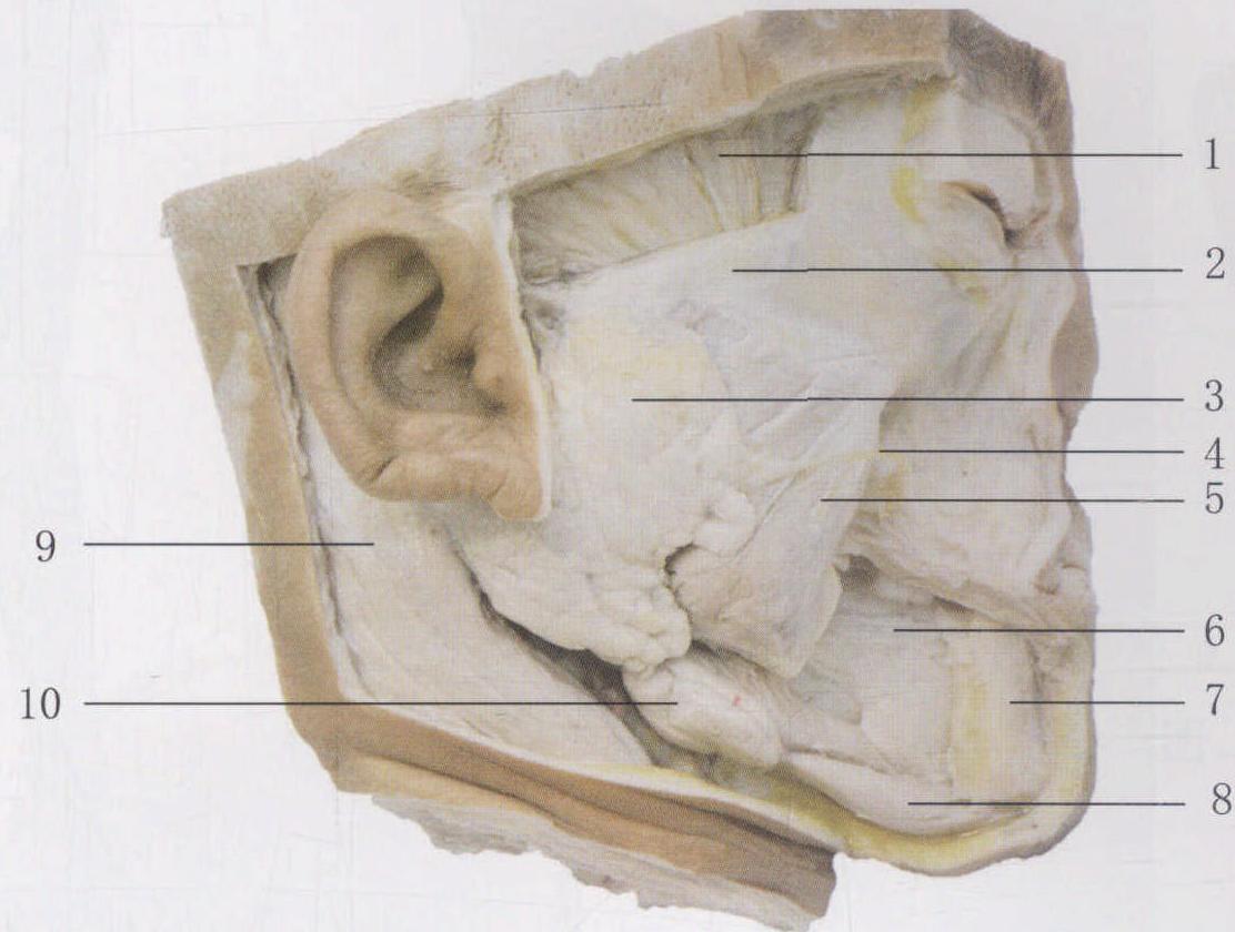 图3-138 面肌、唾液腺(右侧)
